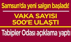 Samsun'da kızamık salgını mı var? 500 vaka ile ilgili yeni açıklama!