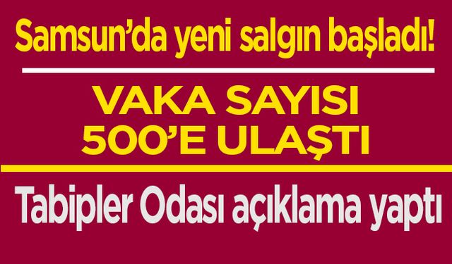 Samsun'da kızamık salgını mı var? 500 vaka ile ilgili yeni açıklama!