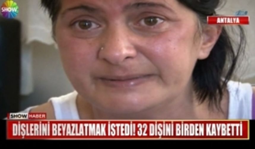 Dişlerini beyazlatmak istedi! 32 dişini birden kaybetti